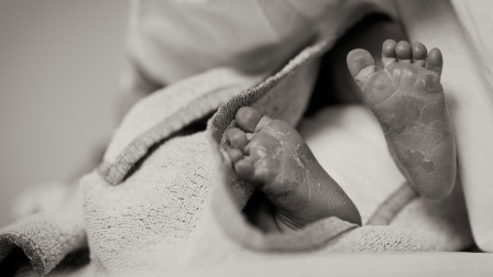 Απίστευτη σύμπτωση στην Αγγλία: Τρία ξαδέρφια γεννήθηκαν την ίδια ημέρα στο ίδιο νοσοκομείο