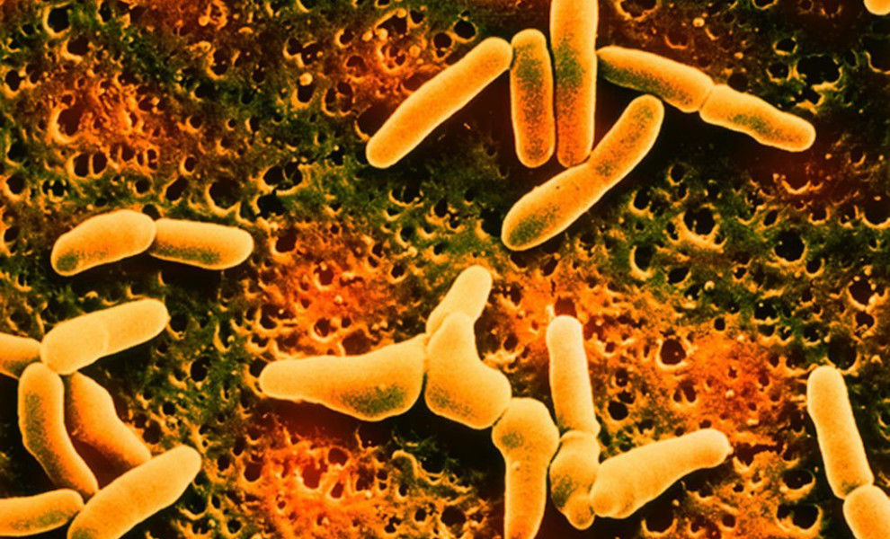 (Photo By BSIP/UIG Via Getty Images)