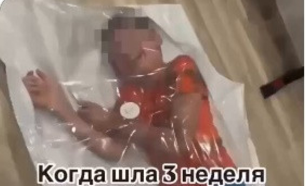 Πλατφόρμα Χ