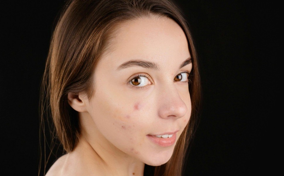 pexels/anna nekrashevich pexels/anna nekrashevich