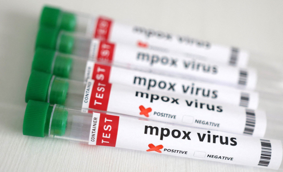 Φυαλλίδια που περιέχουν θετικά δείγματα mpox / Reuters