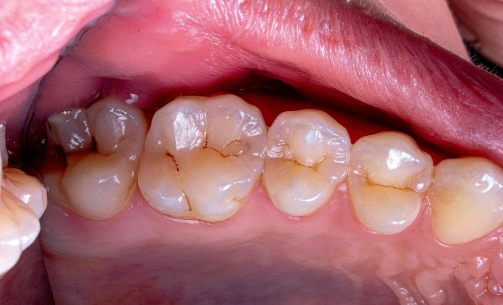 Ozkan Guner - Unsplash