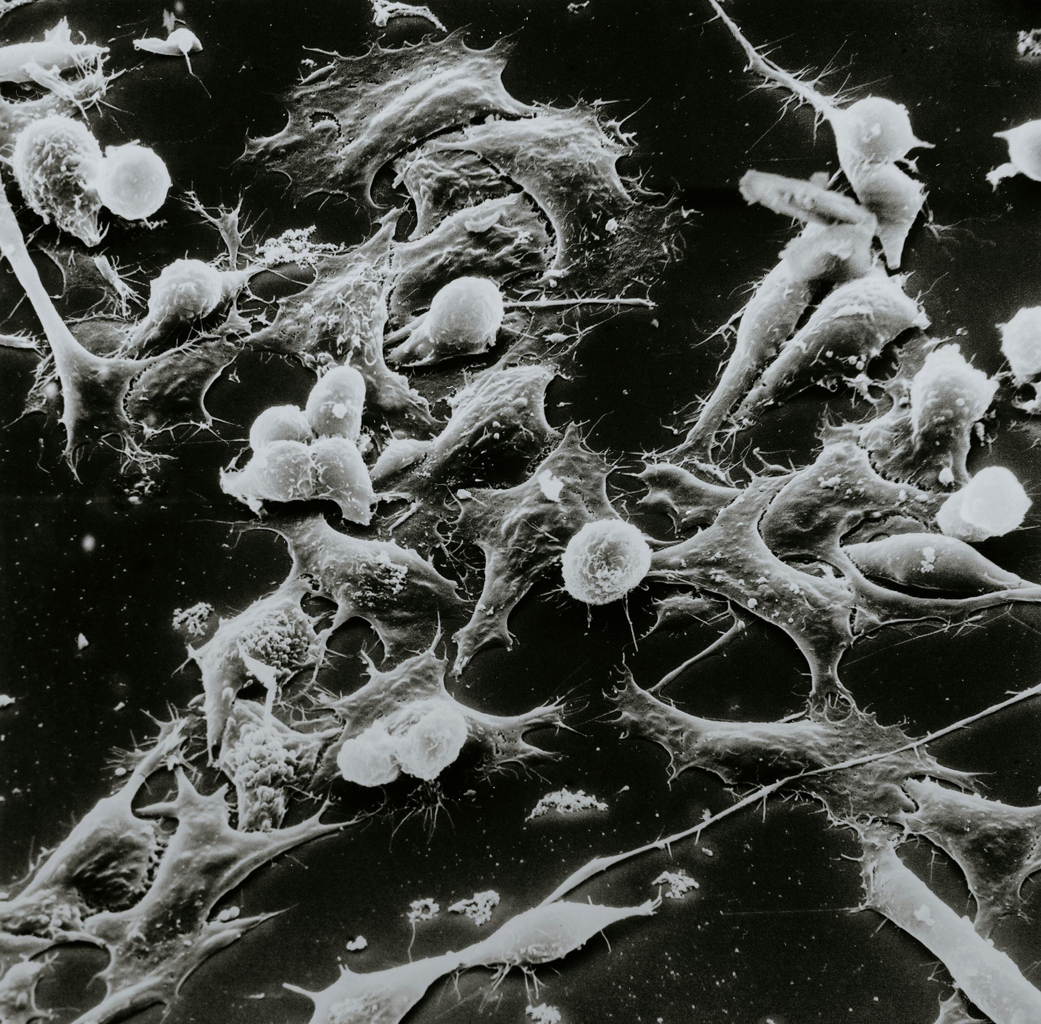 Νέα μελέτη: Καλή η διαλειμματική νηστεία, αλλά ενέχει σοβαρούς κινδύνους