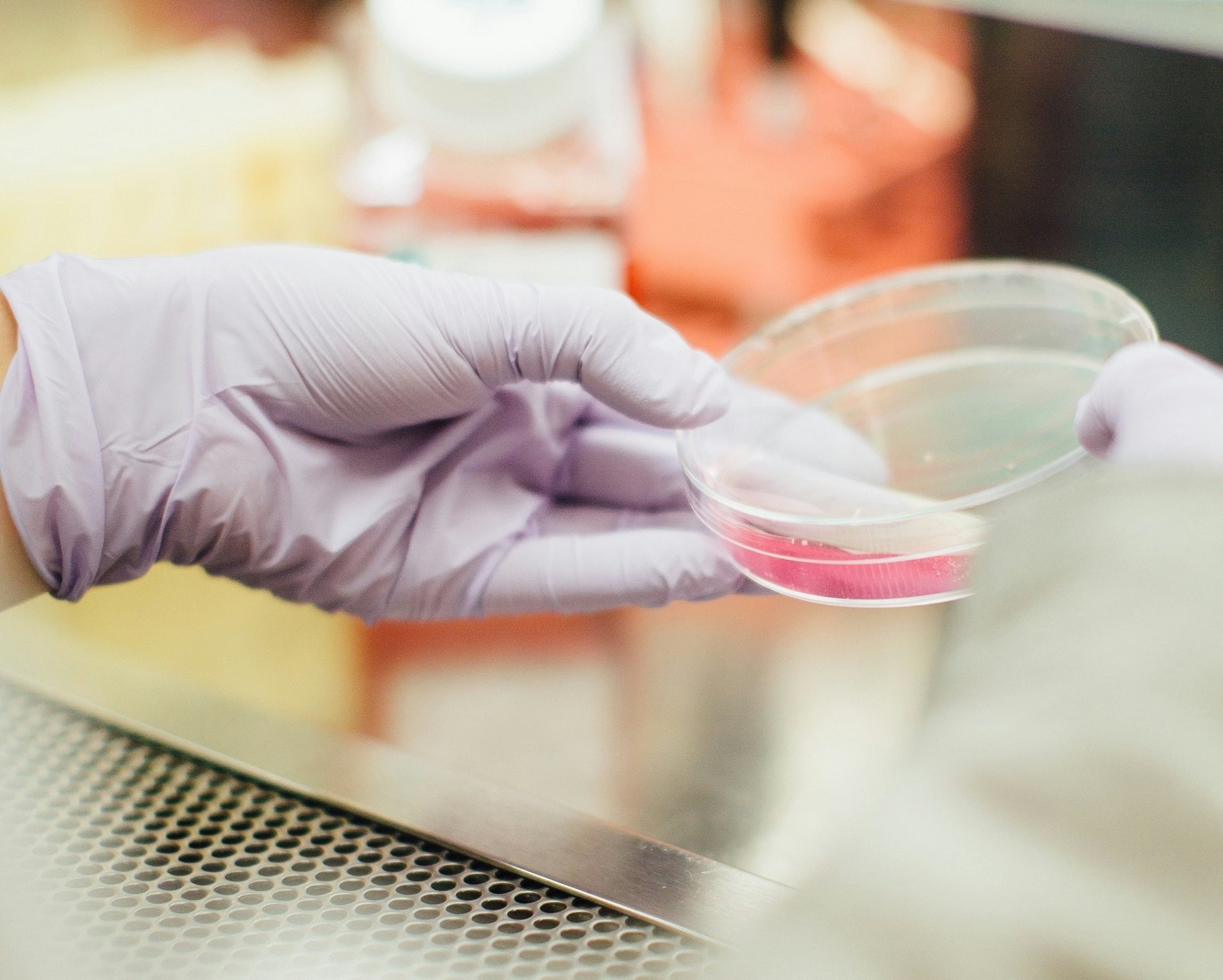 Σαν σήμερα ένας ακατάστατος φυσικός έφερε επανάσταση στην Ιατρική λόγω μίας... μούχλας