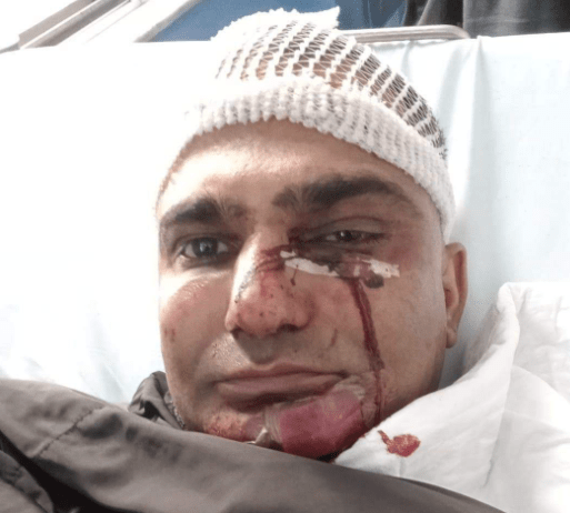 «Βρώμικε Πακιστανέ φύγε από τη χώρα!»: Άγριο ξύλο σε ντελιβερά στα Σεπόλια - Τι λέει στο Action 24