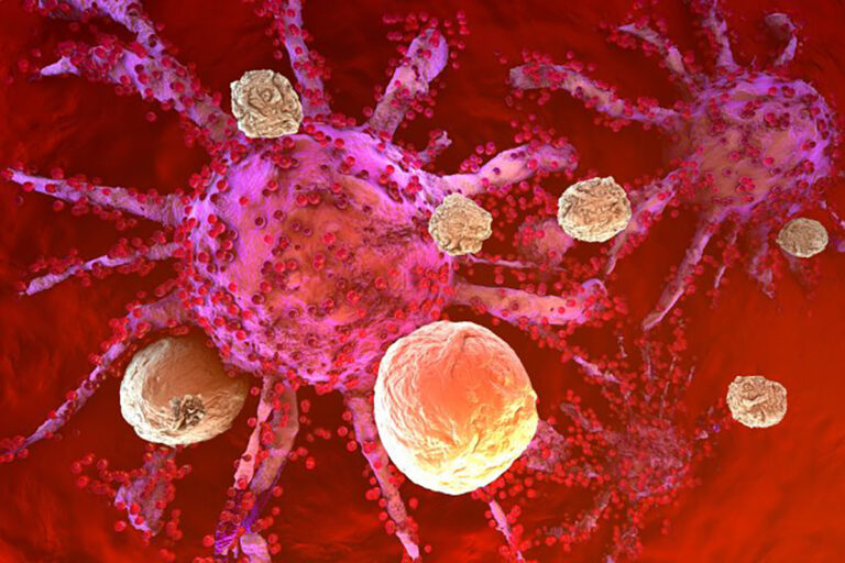Θεραπεία Καρκίνου: Gel με κυτταρική θεραπεία σκοτώνει τα υπολείμματα όγκων